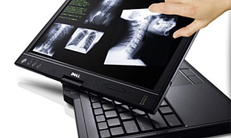 Scherm draaien laptop