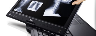 Scherm draaien laptop