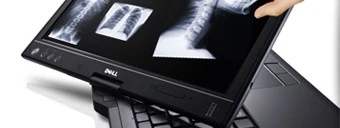 Scherm draaien laptop